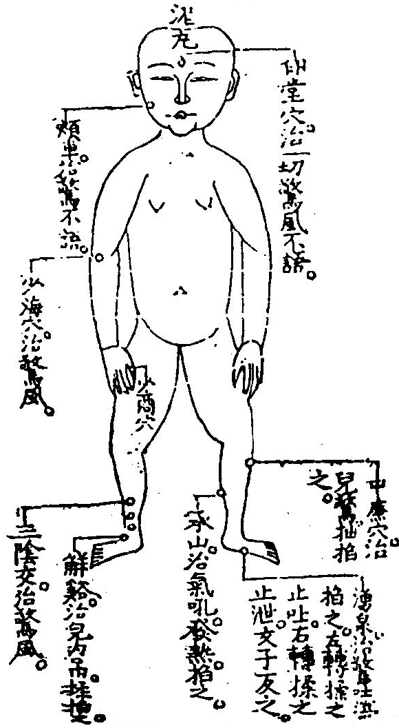 要穴圖